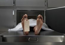 Компания ще използва стволови клетки в опит да съживи мъртвите